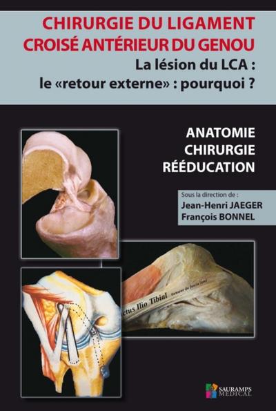 Chirurgie du ligament croisé antérieur du genou