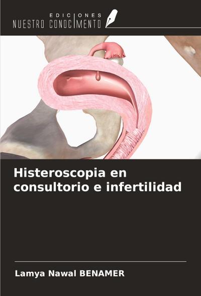 Histeroscopia en consultorio e infertilidad