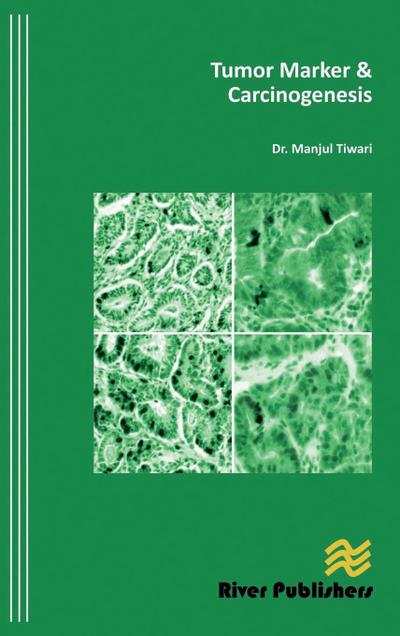 Tumor Marker and Carcinogenesis
