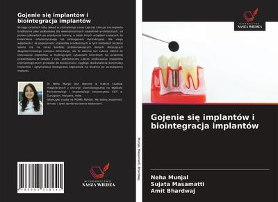 Gojenie si¿ implantów i biointegracja implantów