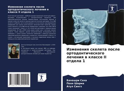 Izmeneniq skeleta posle ortodonticheskogo lecheniq w klasse II otdela 1