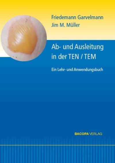 Ab- und Ausleitungsverfahren in der TEN/TEM.