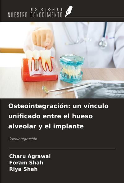 Osteointegración: un vínculo unificado entre el hueso alveolar y el implante