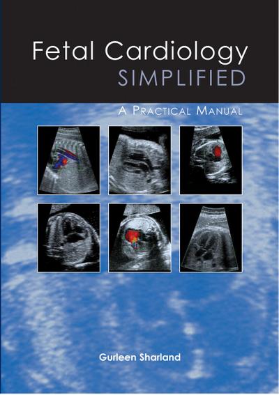 Fetal Cardiology Simplified