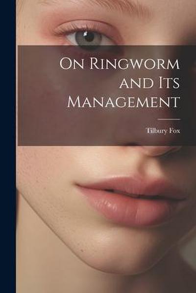 On Ringworm and Its Management