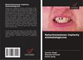 Natychmiastowe implanty stomatologiczne
