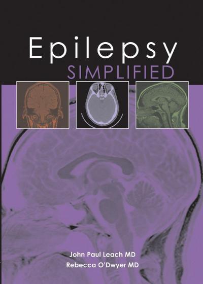 Epilepsy Simplified