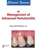 Clinical Success in Management of Advanced Periodo