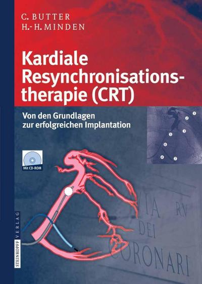Kardiale Resynchronisationstherapie (CRT)