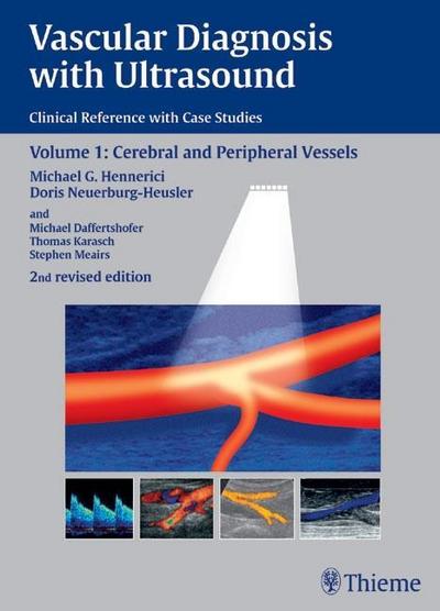 Vascular Diagnosis with Ultrasound Cerebral and Peripheral Vessels
