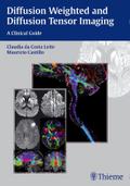 Diffusion Weighted and Diffusion Tensor Imaging
