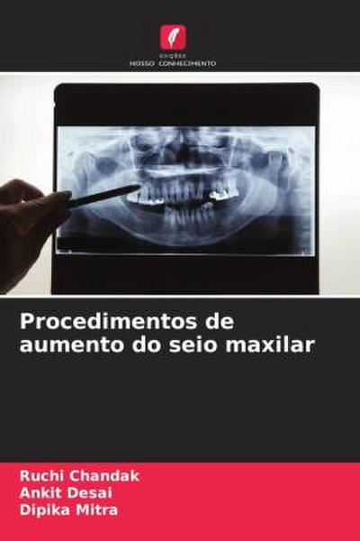 Procedimentos de aumento do seio maxilar