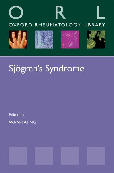 Sj?gren’s Syndrome