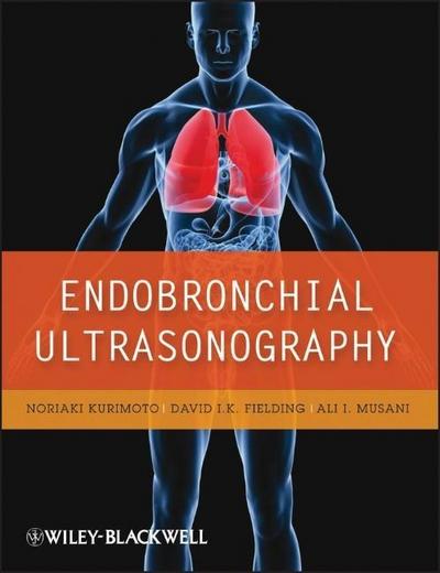 Endobronchial Ultrasonography, w. DVD-ROM