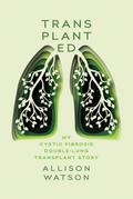 Transplanted
