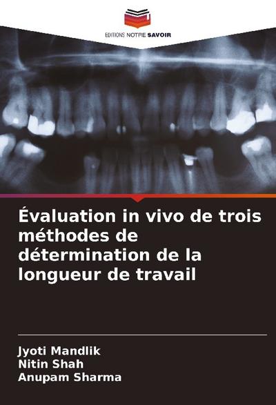 Évaluation in vivo de trois méthodes de détermination de la longueur de travail
