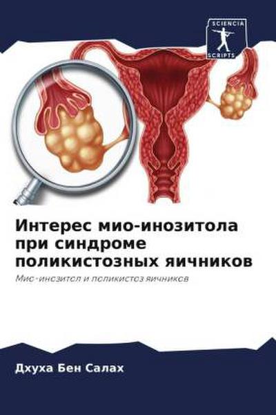 Interes mio-inozitola pri sindrome polikistoznyh qichnikow