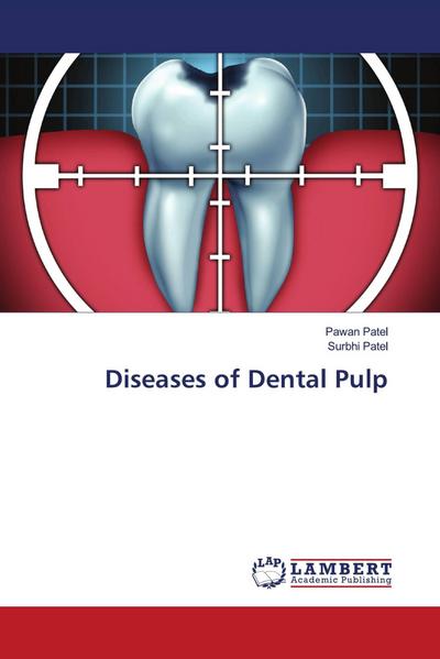 Diseases of Dental Pulp