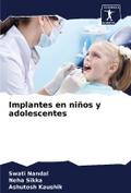 Implantes en niños y adolescentes