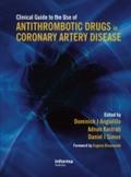 Clinical Guide to the Use of Antithrombotic Drugs 
