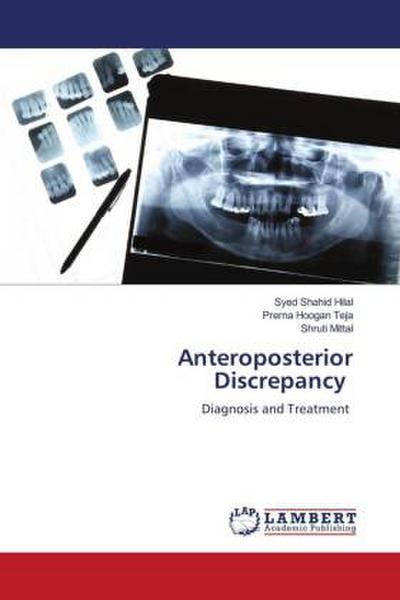 Anteroposterior Discrepancy