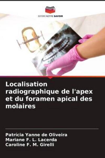 Localisation radiographique de l’apex et du foramen apical des molaires