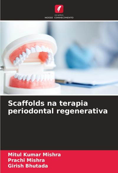 Scaffolds na terapia periodontal regenerativa