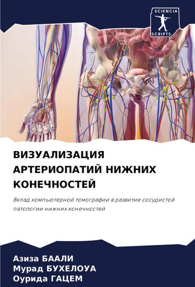 VIZUALIZACIYa ARTERIOPATIJ NIZhNIH KONEChNOSTEJ