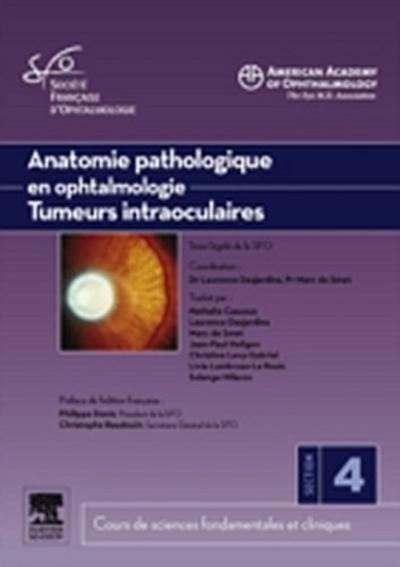 Anatomie pathologique en ophtalmologie. Tumeurs intraoculaires
