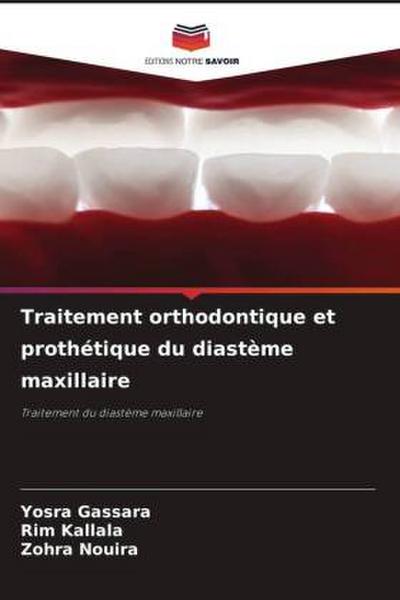 Traitement orthodontique et prothétique du diastème maxillaire