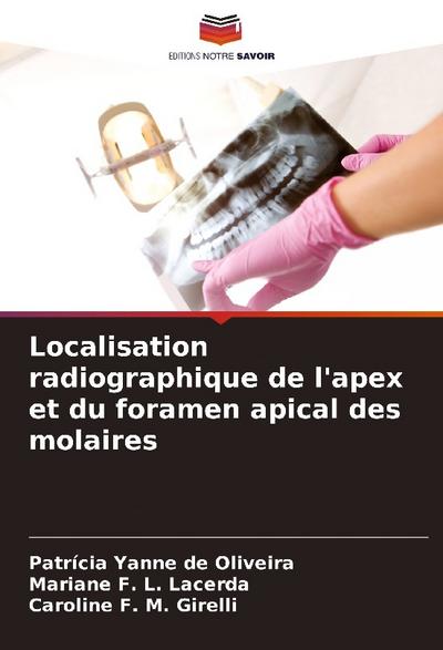 Localisation radiographique de l’apex et du foramen apical des molaires