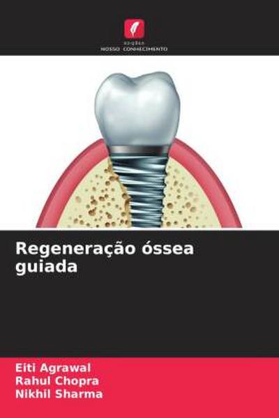 Regeneração óssea guiada