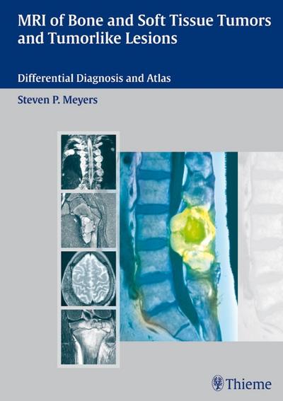 MR Imagaging of Bone and Soft Tissue Tumors Tumor-like Lesions