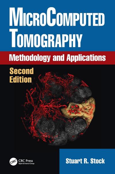 MicroComputed Tomography