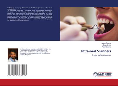 Intra-oral Scanners