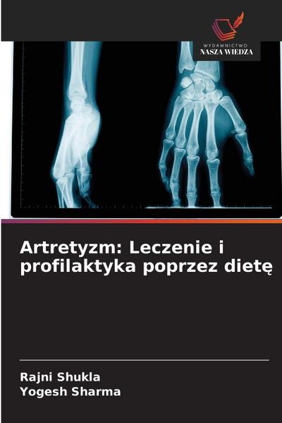 Artretyzm: Leczenie i profilaktyka poprzez diet¿