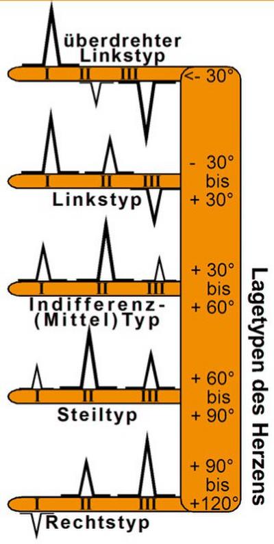 EKG Lineal professional II - 2015