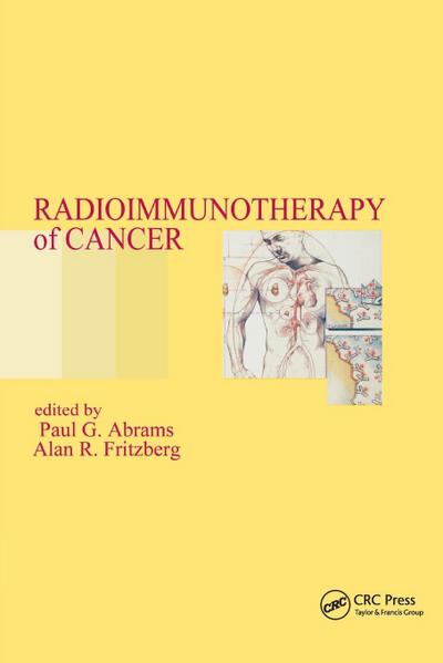 Radioimmunotherapy of Cancer