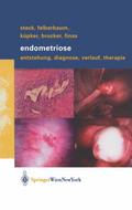 Endometriose