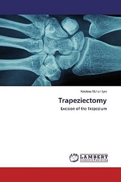 Trapeziectomy