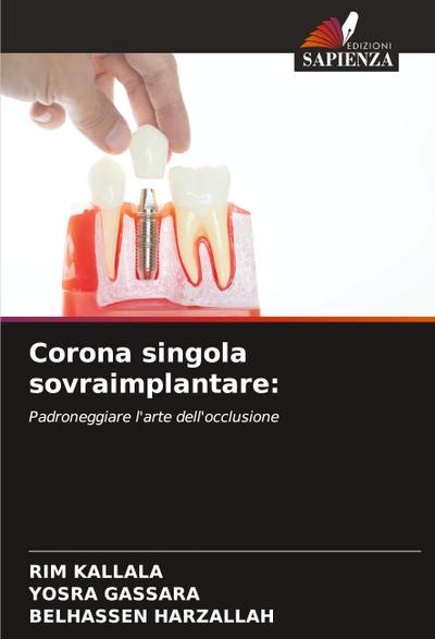 Corona singola sovraimplantare: