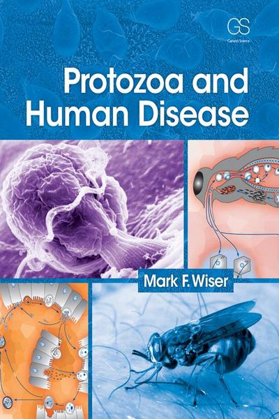 Protozoa and Human Disease