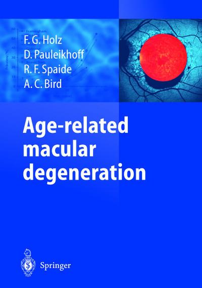 Age-related macular degeneration