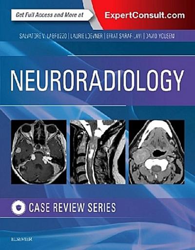 Neuroradiology Imaging Case Review