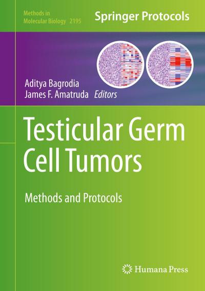 Testicular Germ Cell Tumors