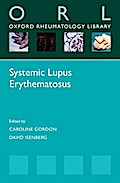 Systemic Lupus Erythematosus