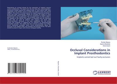 Occlusal Considerations in Implant Prosthodontics