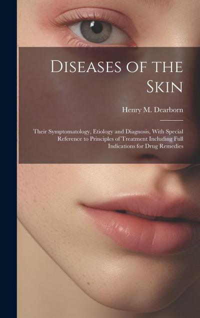Diseases of the Skin: Their Symptomatology, Etiology and Diagnosis, With Special Reference to Principles of Treatment Including Full Indicat