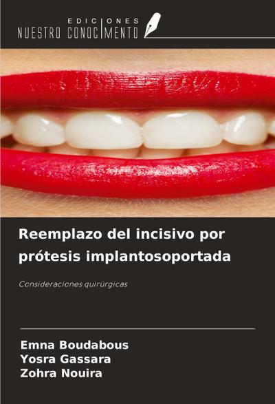 Reemplazo del incisivo por prótesis implantosoportada