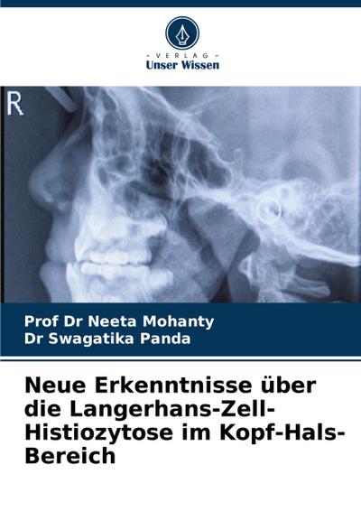 Neue Erkenntnisse über die Langerhans-Zell-Histiozytose im Kopf-Hals-Bereich